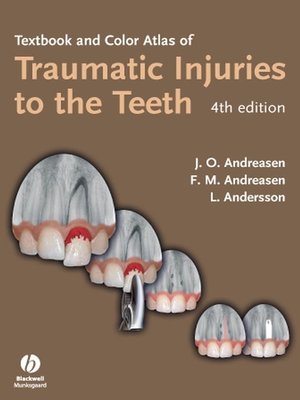cover image of Textbook and Color Atlas of Traumatic Injuries to the Teeth